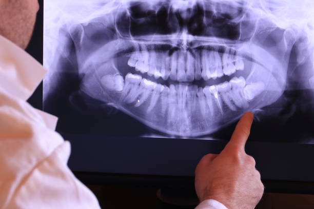 Best Broken Tooth Emergency  in Detroit, MI